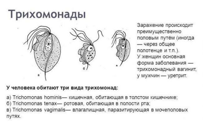 Уретрит: признаки, диагностика, как лечить