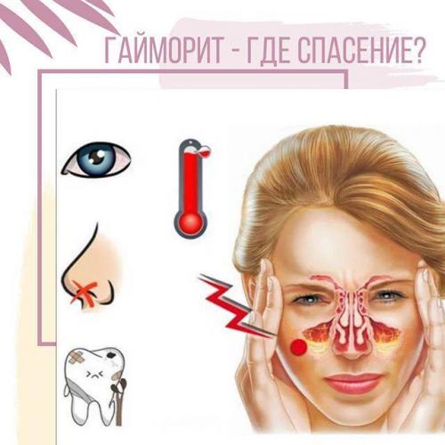 Особенности точечного массажа при лечении насморка