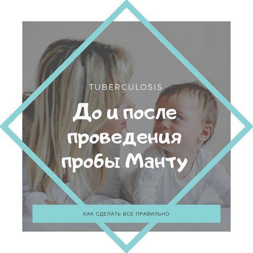 Реакция манту: норма у детей, положительная, отрицательная