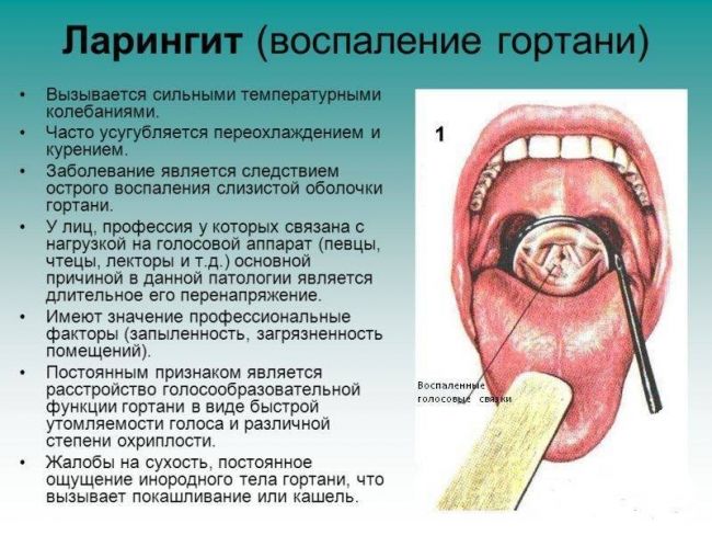 Болит горло. причины. фото.