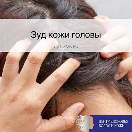 Грибок малассезия у людей лечение