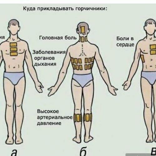 Применение горчичников от кашля: польза и вред, инструкции, правила изготовления дома