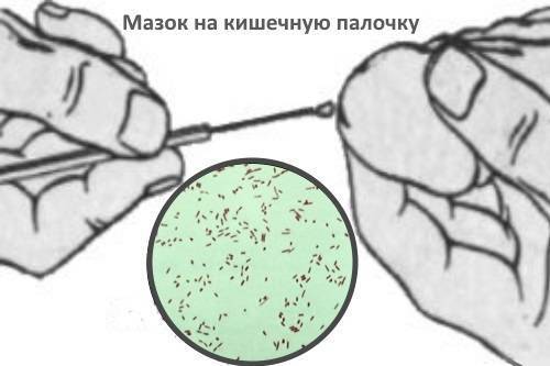 Девочки, это пипец? пришли мазки! heeeeeeelp!!! - запись пользователя лизушка (id1141417) в сообществе эко - мама в категории анализы и процедуры. помощь в расшифровке результатов - babyblog.ru