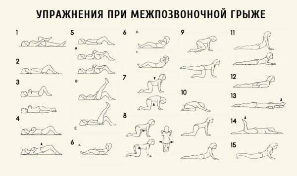 Лфк после удаления грыжи поясничного отдела позвоночника