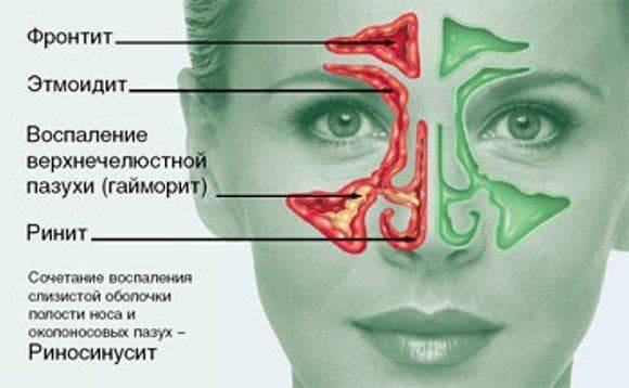 Туя эдас 801 для детей при насморке