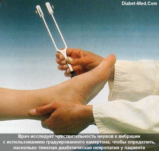 Диабетическая полинейропатия