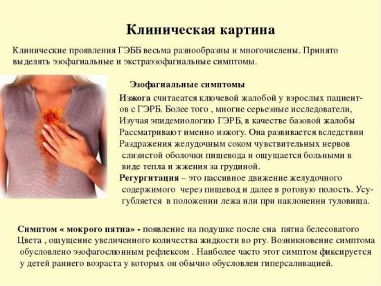 Гастроэзофагеальная рефлюксная болезнь (гэрб)