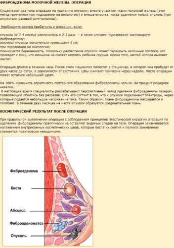 Фиброаденома молочной железы: что это такое, методы лечения
