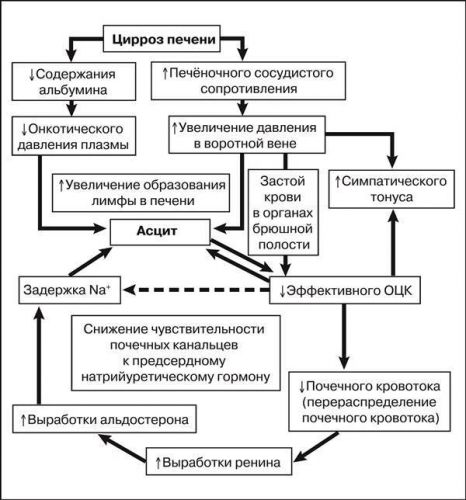 Почему развивается асцит, как его распознать и вылечить