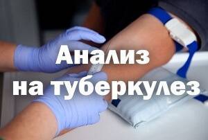 Целесообразность проведения анализа мочи на туберкулез методом пцр