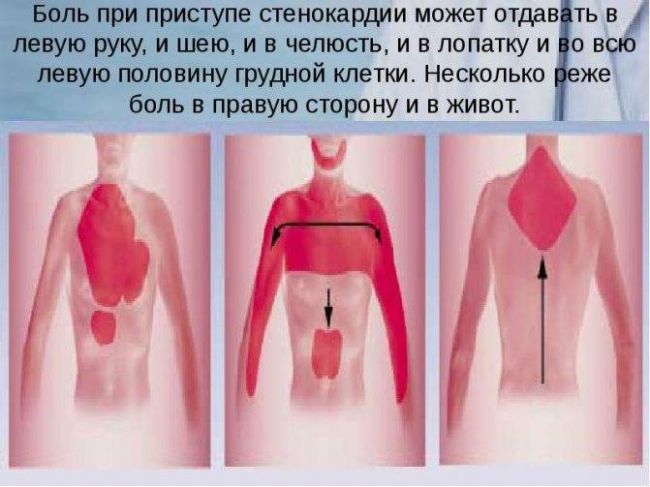 Симптомы шох. может ли болеть горло при шейном остеохондрозе?