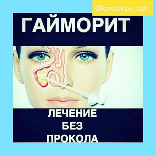 Помогает ли ибупрофен от головной боли?