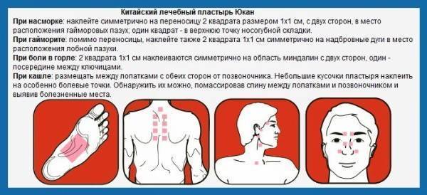 Куда наклеивать перцовый пластырь при кашле