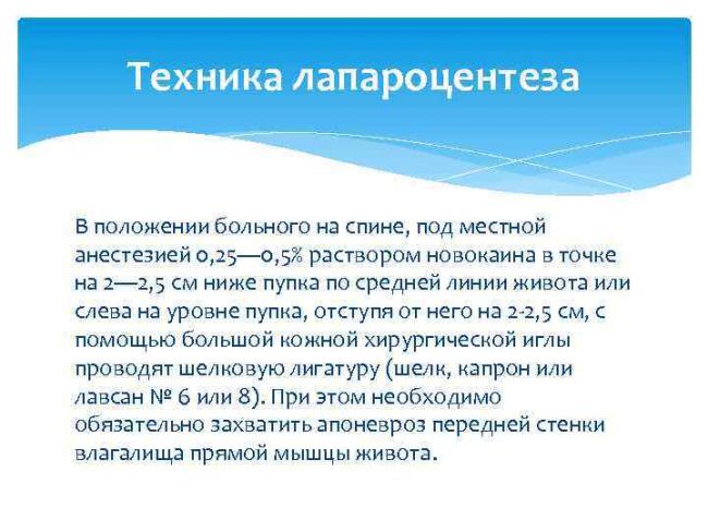 Лапароцентез (пункция брюшной полости): показания, проведение