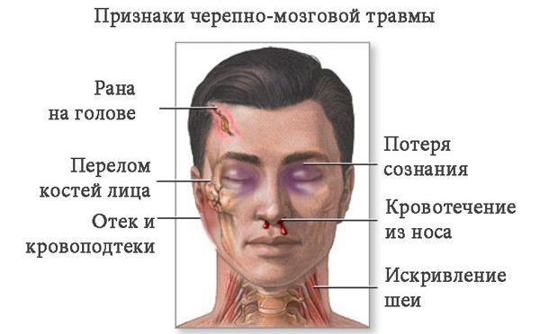 Онемение кожи головы с левой стороны. немеет голова: причины и особенности лечения