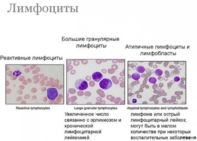 Лимфоциты — википедия с видео // wiki 2