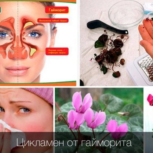 Гайморит – лечение антибиотиками: какие хорошо помогают