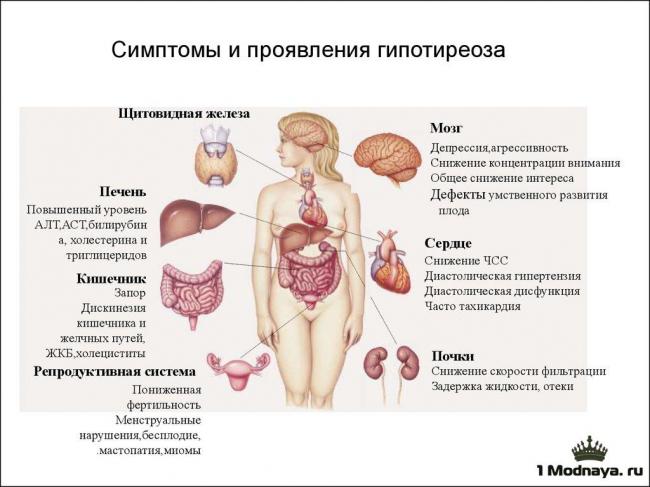 Гипотиреоз - лечение препаратом эндонорм