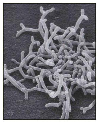Lactococcus и другие молочнокислые стрептококки: развитие, значение и применение в пищевой промышленности