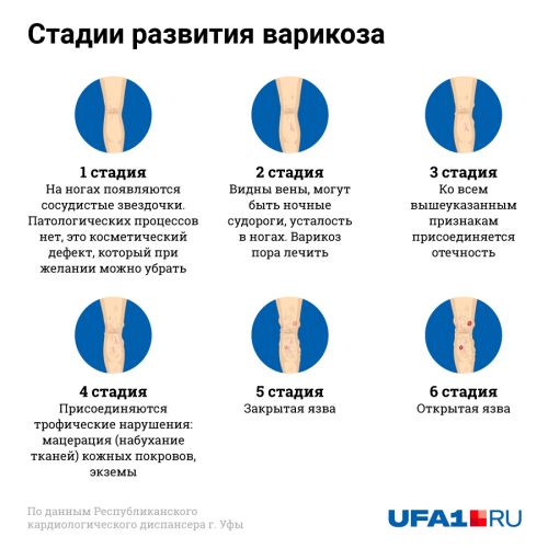 Тромбоз: причины, симптомы, лечение, профилактика