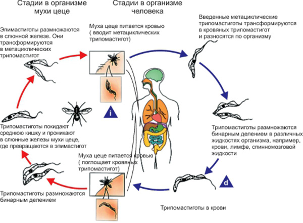 Сонная болезнь