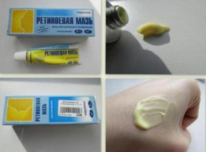 Ретиноевая мазь (retinoic ointment)