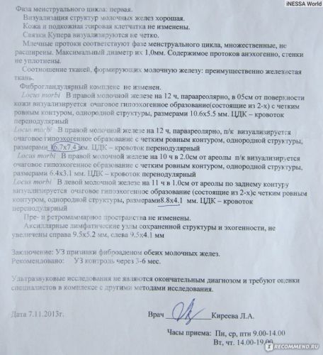 Фиброаденома молочной железы: опасно ли новообразование