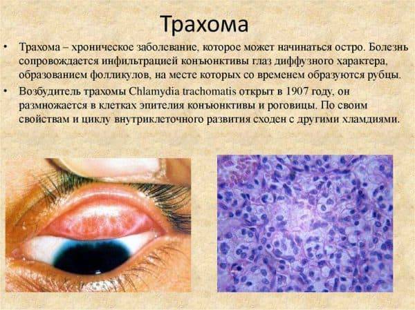 Проверка зрения на цветовосприятие для водителей