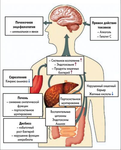 Дисциркуляторная энцефалопатия | симптомы | диагностика | лечение - docdoc.ru