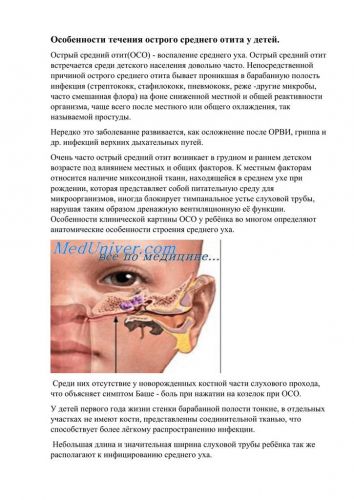 Острый средний отит (осо)