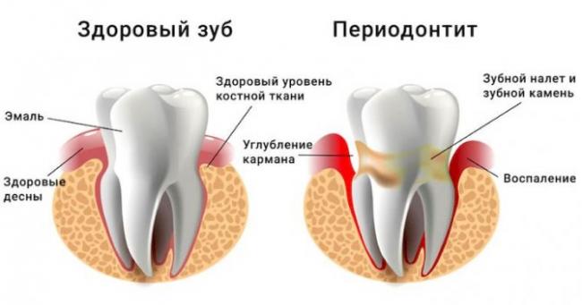 Почему немеет голова и бегают мурашки