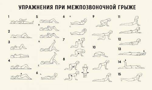 Лечебная гимнастика для позвоночника при грыже поясничного отдела