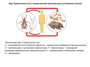 Сонная болезнь