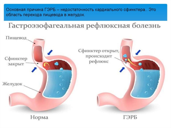 Мотилиум (motilium) инструкция по применению