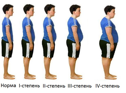Лечение ожирения у детей