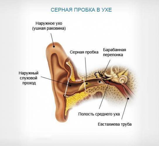Как правильно промыть ухо от серной пробки в домашних условиях?
