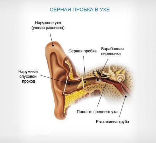 Как легко и просто удалить ушную пробку в домашних условиях