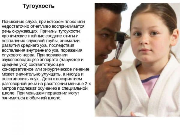 Сенсоневральная тугоухость 1, 2, 3, 4 степени: симптомы, лечение