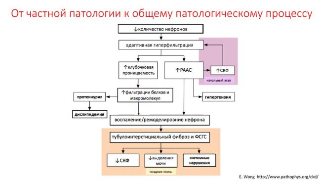 Нефросклероз (сморщенная почка): что это такое, причины, симптомы, лечение, исход заболевания, профилактика