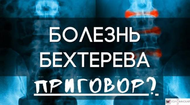 Болезнь бехтерева, или анкилозирующий спондилит: симптомы, причины, лечение