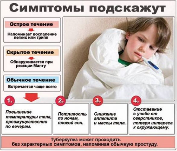 Туберкулёз внутригрудных лимфатических узлов у детей