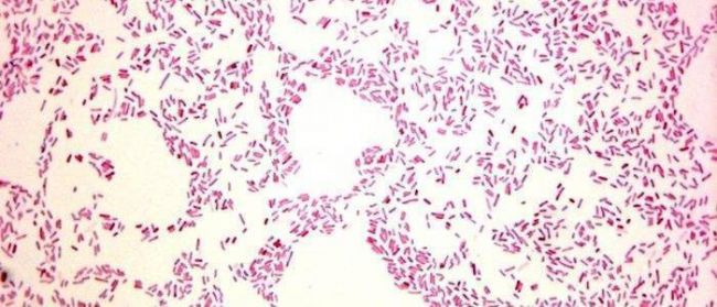 Escherichia coli (эшерихия коли) у беременных в моче: откуда, лечение
