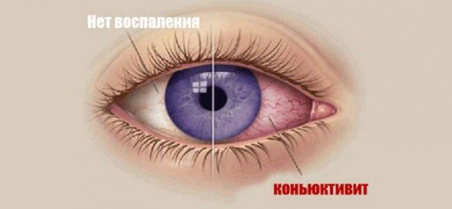 Тетрациклиновая мазь для глаз