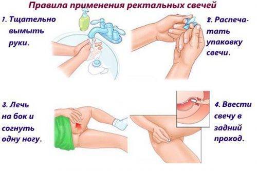 Свечи от глистов отзывы
