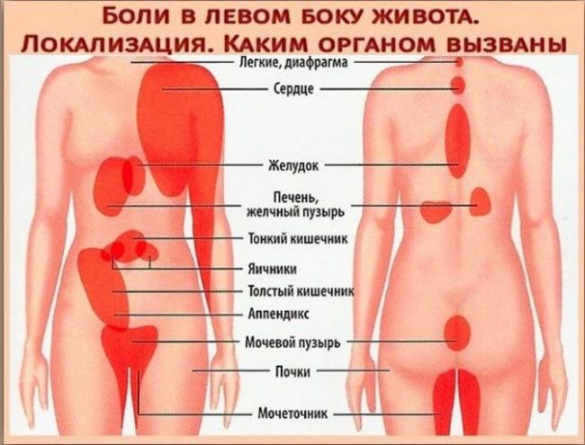 Болит спина: что делать?