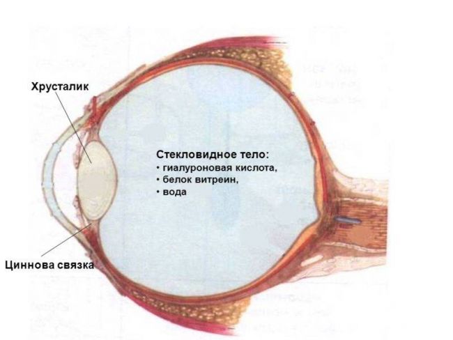 Деструкция стекловидного тела