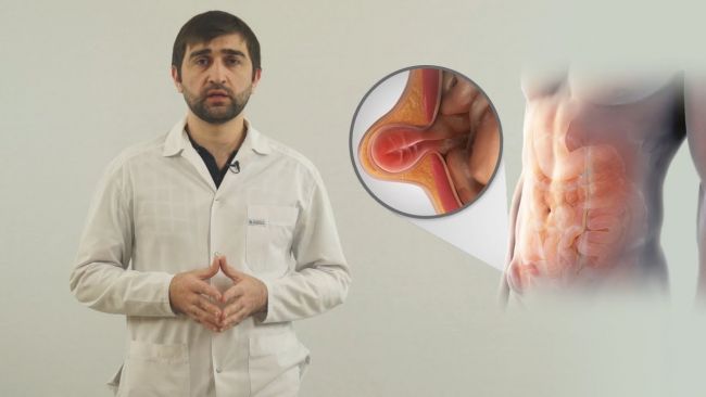 Питание после удаления паховой грыжи
