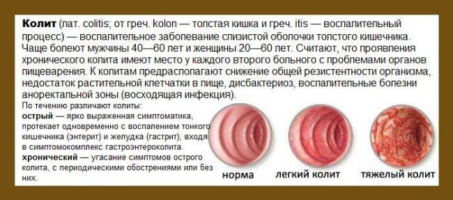 Гастрит желудка и колит кишечника