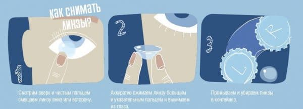 Ночные линзы для восстановления зрения: чудо офтальмологии или польза не для всех