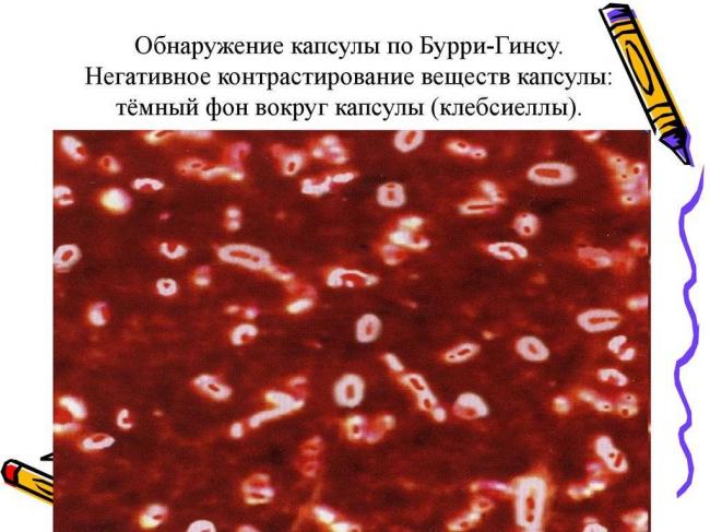 Основные методы лабораторного выявления бактерий